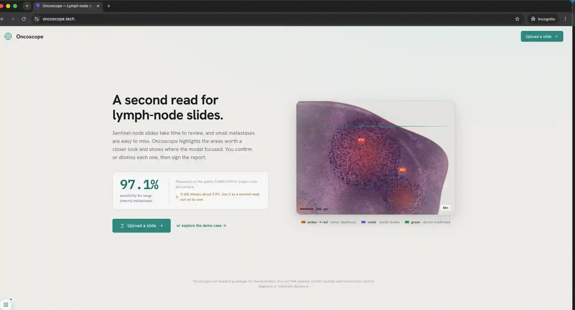 Oncoscope preview